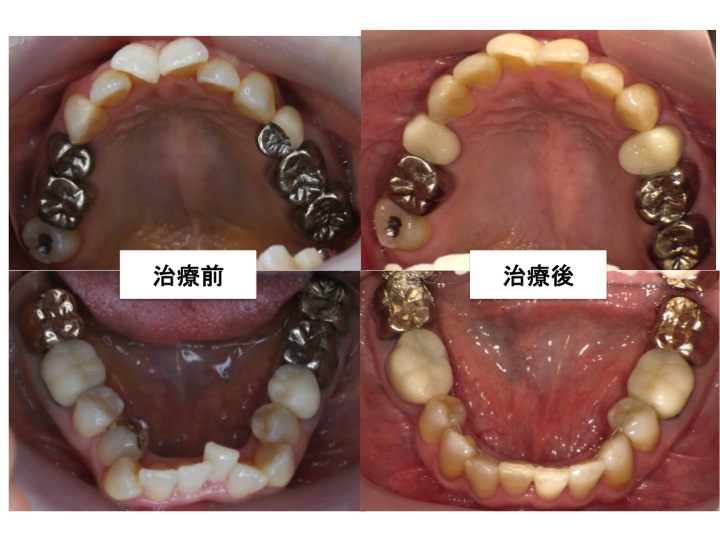 歯の移植 | KOMURA BLOG