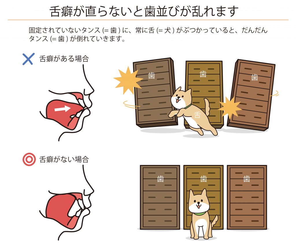 矯正の期間が長引く場合 こむら小児歯科 矯正歯科blog