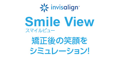スマイルビュー、矯正後の笑顔をシミュレーション