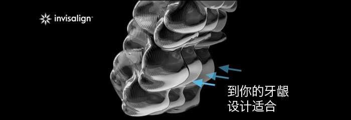 あなたの歯茎に合わせてデザイン-中国語